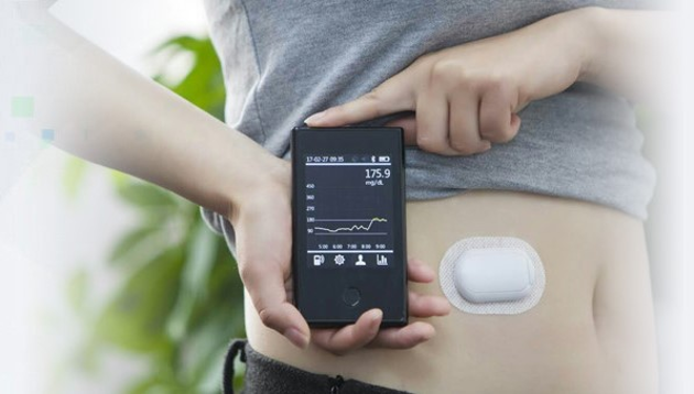 Das CGM-System überwacht über ein kleines Pflaster am Bauch den Blutzuckerwert und soll das Leben von Diabetikern erheblich erleichtern