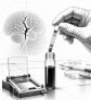 ai-alzheimer-gut-metabolite-imi-propionate